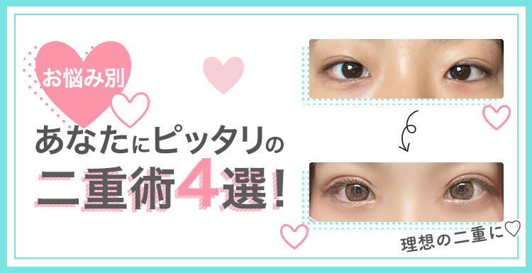 あなたにピッタリの二重術で愛されeyeになろう♡